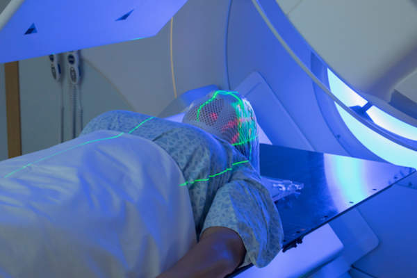 女子接受放射治疗脑癌。