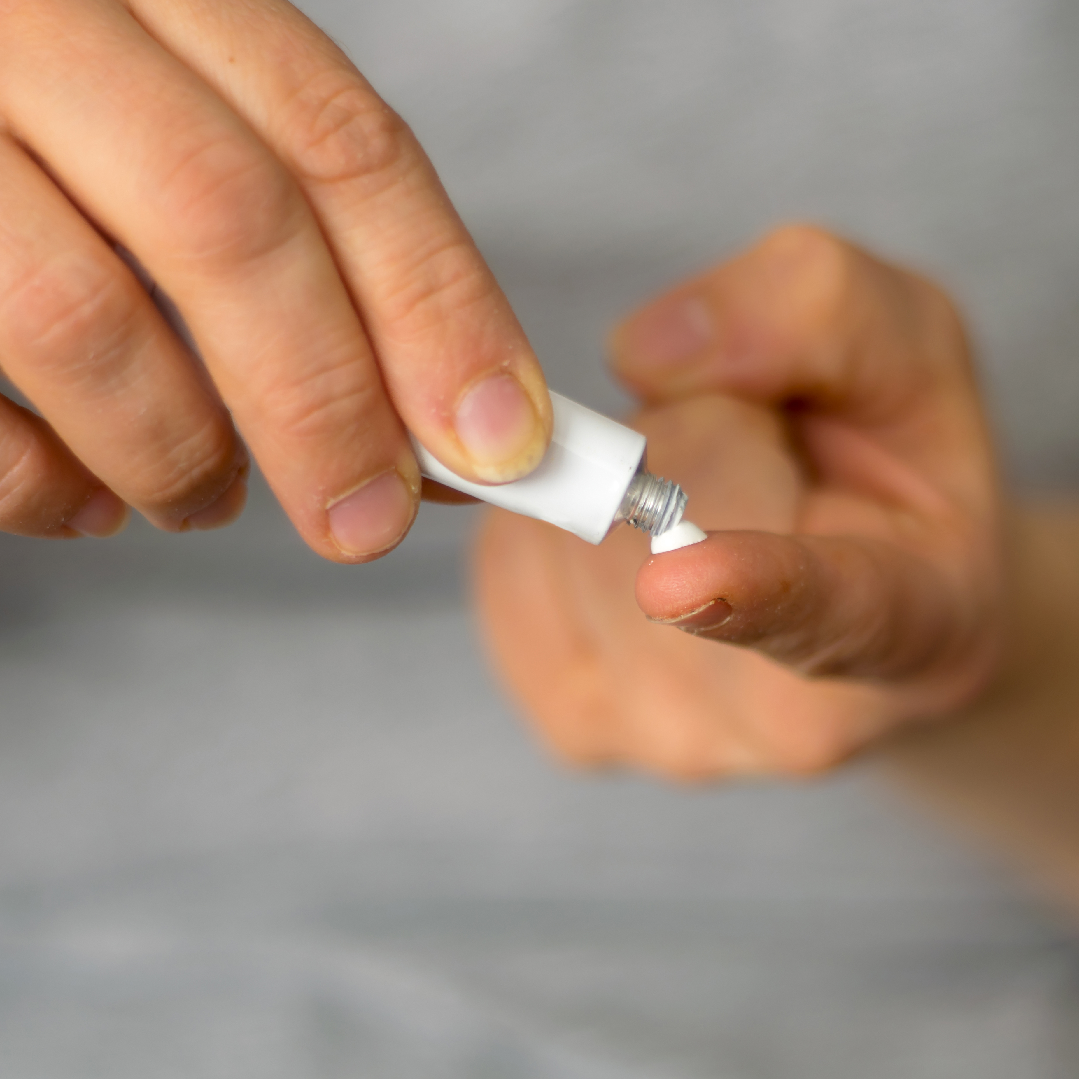 关闭一个女人的手挤压局部奶油从管到手指。