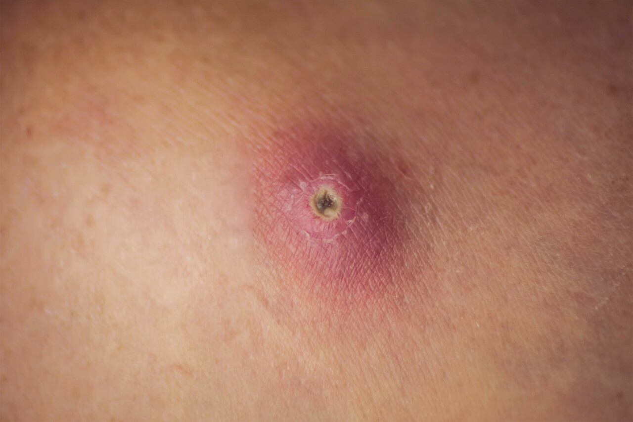 What kind of rash is this? It's itchy and on my right breast. I'm 22 and  female. I get it on my stomach sometimes as well. : r/Dermatology