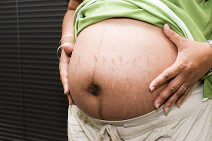 对孕妇腹部的妊娠纹。