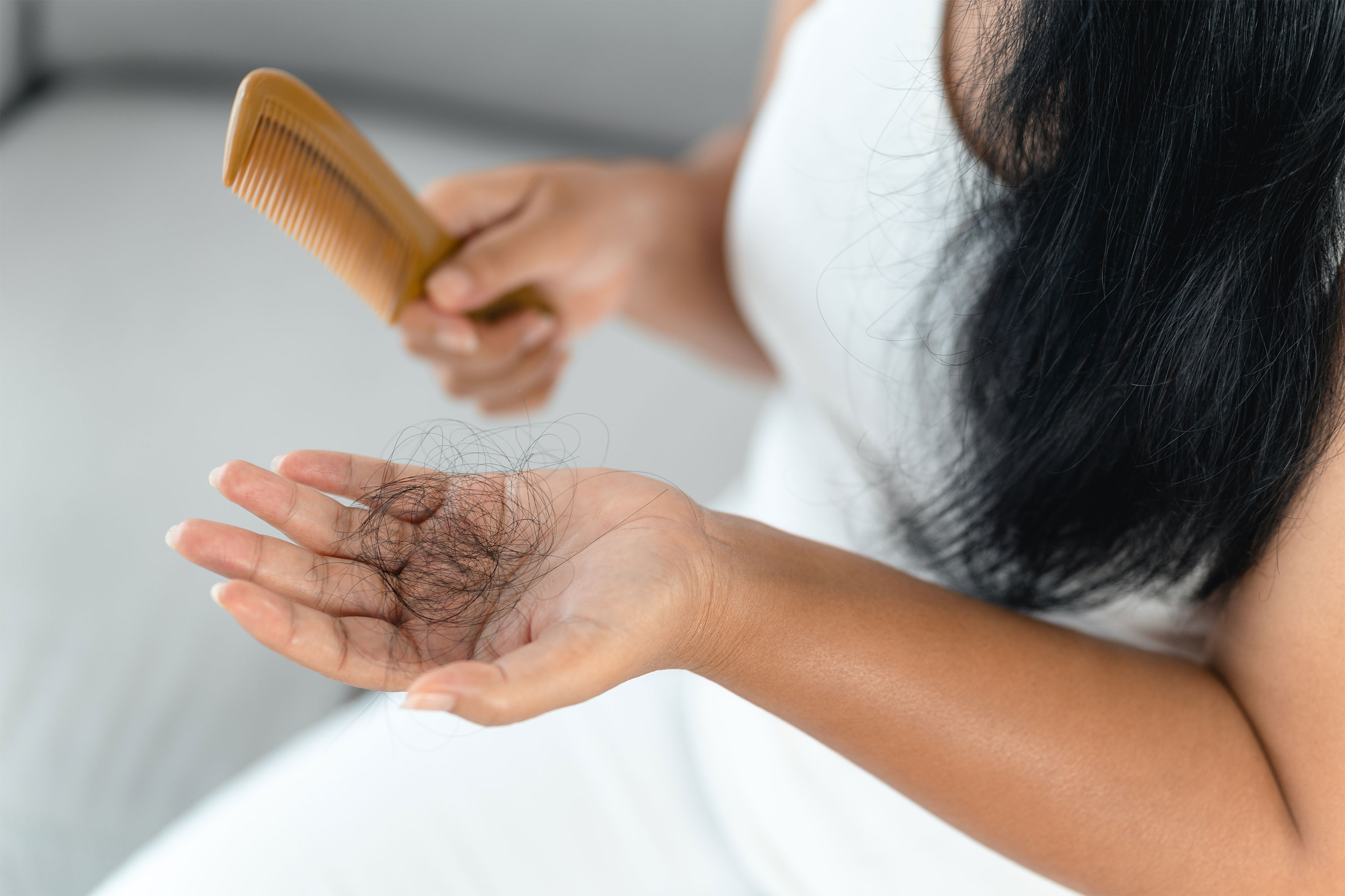 Epilepsy Medication Causing Hair Loss