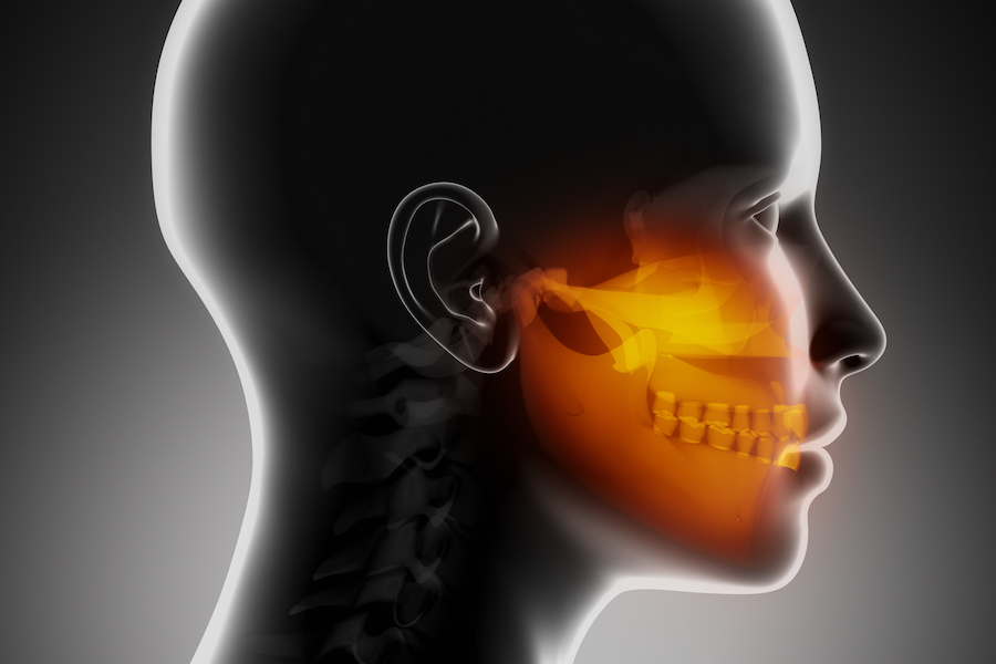 Movable Lump On Jaw Line Captions Graphic