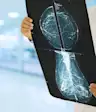 mammogram