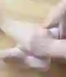 脚踝肿胀
