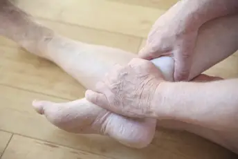 踝关节肿胀