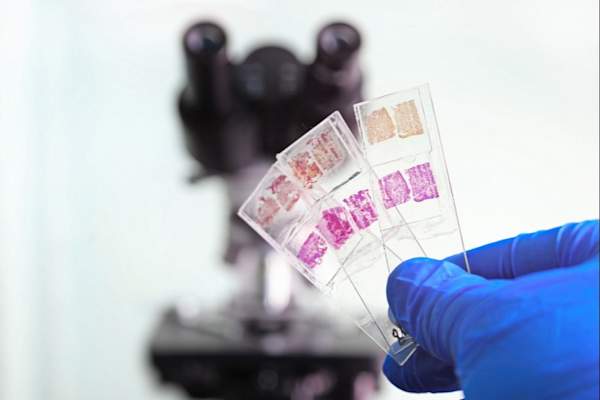 显微镜切片活检