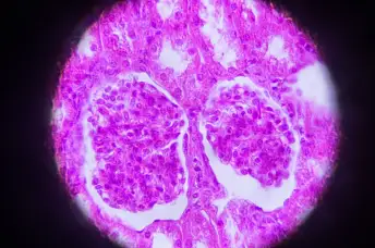 显微镜肾截面