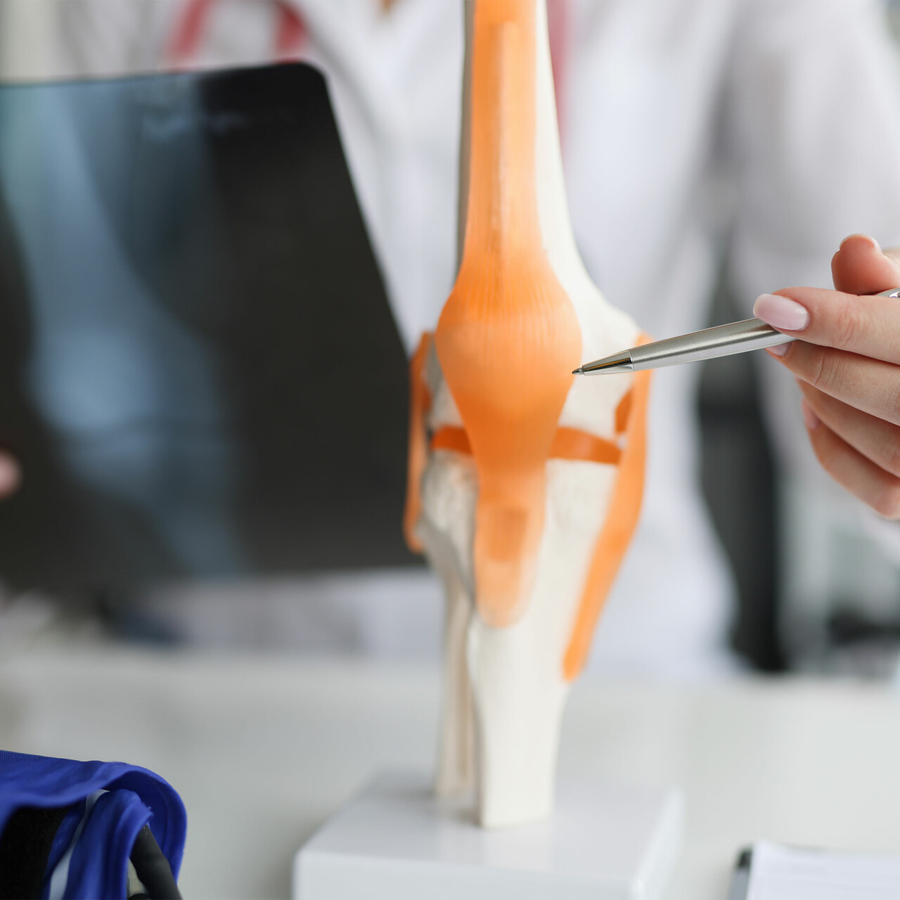 医生指着特写的膝关节模型