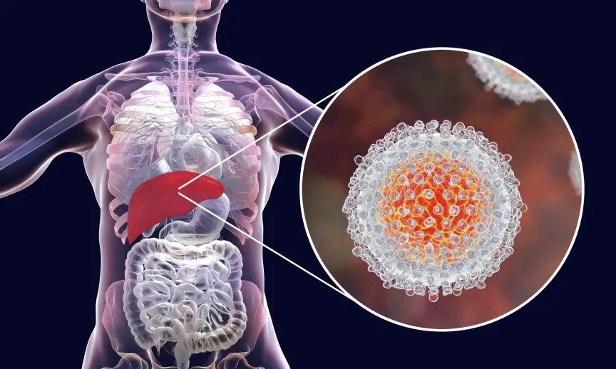 9 Ways Chronic Hepatitis C Can Affect Your Body