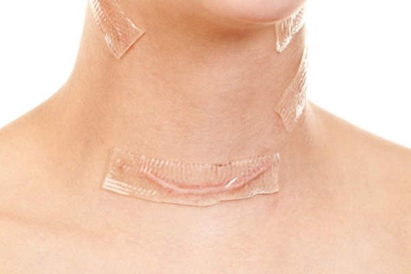 人与多颈部疤痕,治疗他们。