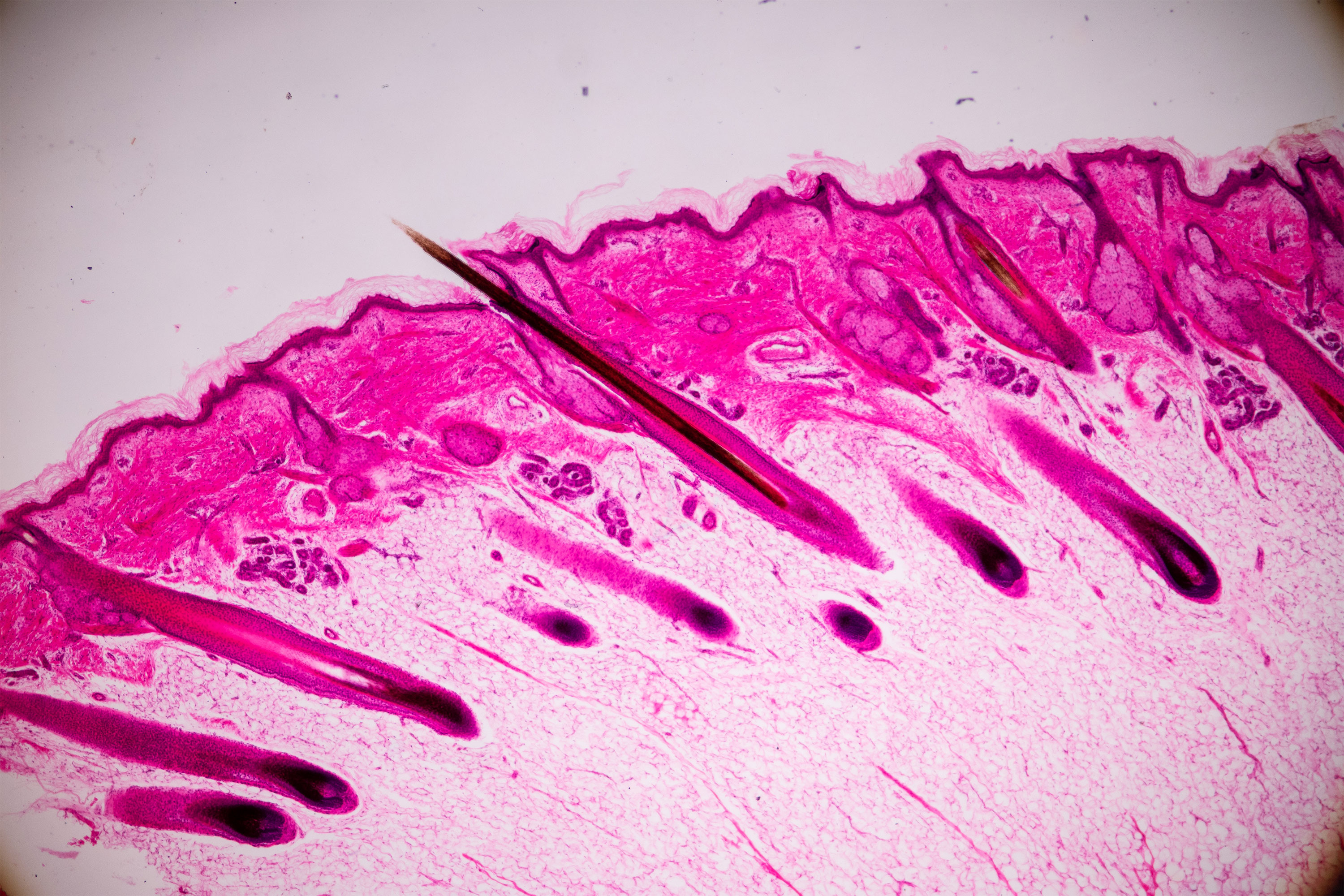 120 Human Hair Microscope Photos and Premium High Res Pictures  Getty  Images
