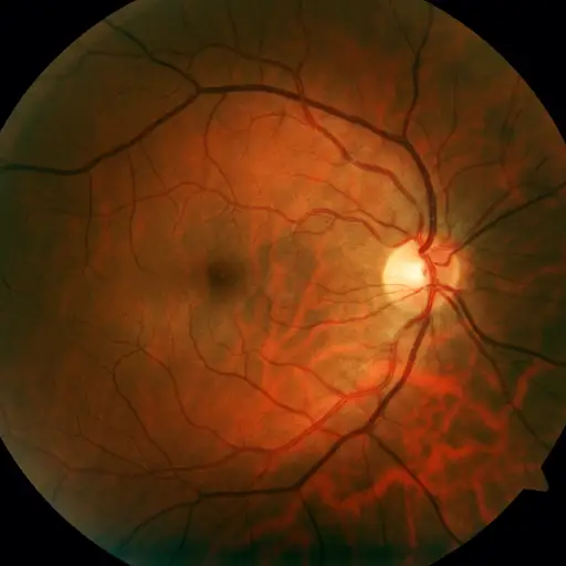 retina