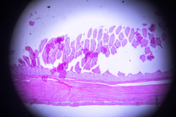 小肠切片显微镜检查