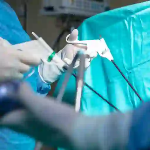 腹腔镜检查