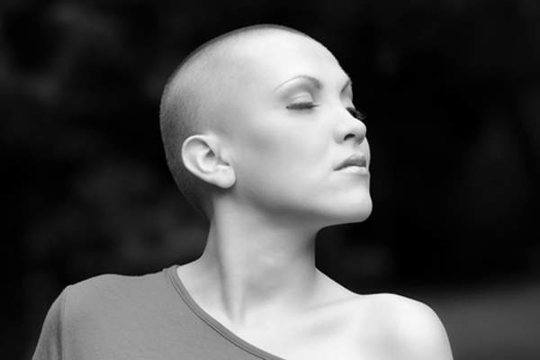 女性转移性乳腺癌概念。