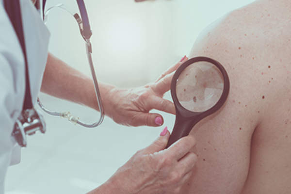 皮肤科医生检查皮肤。