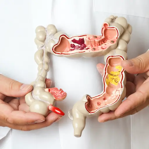 结肠模型
