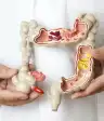 结肠模型