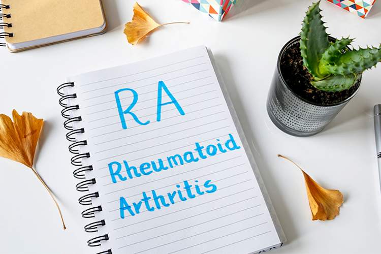 类风湿关节炎笔记在笔记本上。