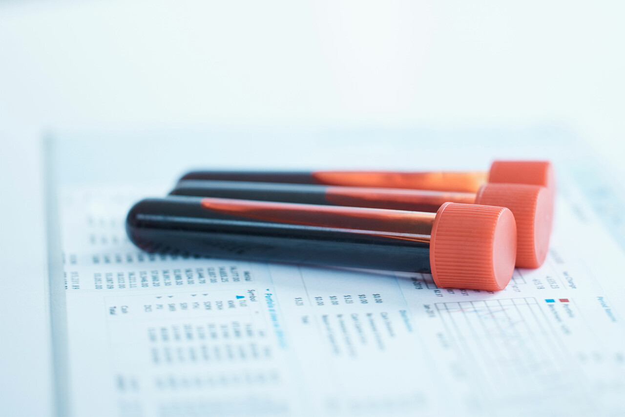 的干脆烧掉试管躺在上面的测试结果