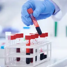 检测实验室里的小瓶血液。