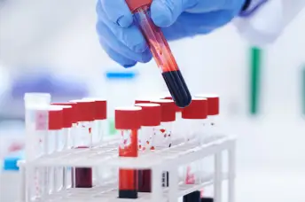 检测实验室里的小瓶血液。