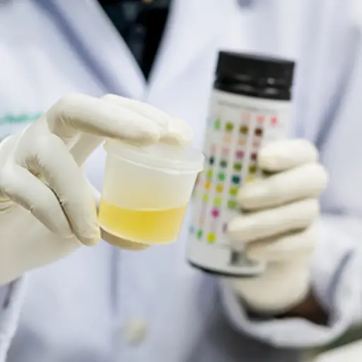 Doctor performing a test on a urine sample.