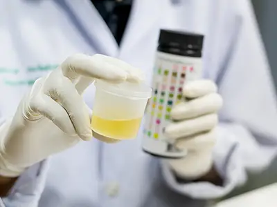Doctor performing a test on a urine sample.