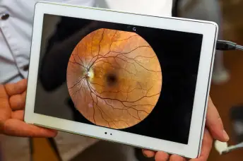 视网膜在平板电脑上