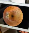 视网膜上的平板电脑
