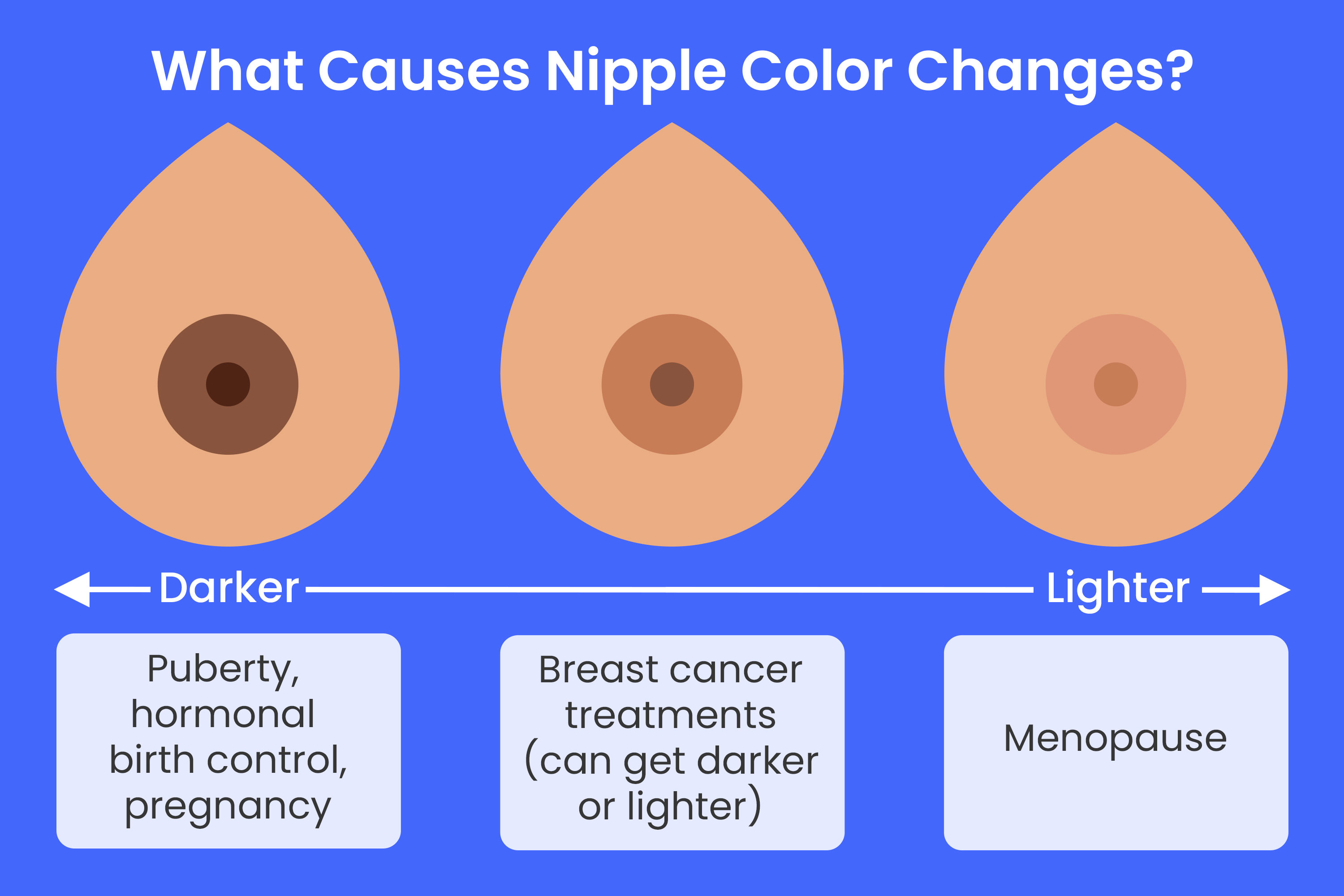 Nipple Color Changes: Is It Normal and What Causes Them?