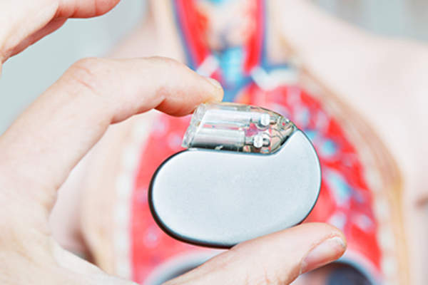 医生手持植入式心脏装置。