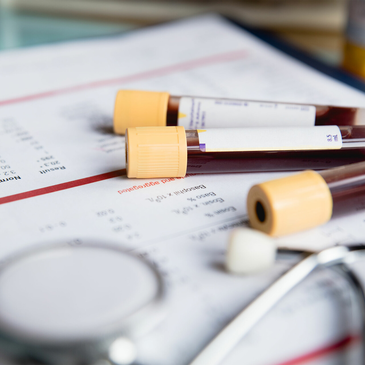 血液试管和测试结果的视图