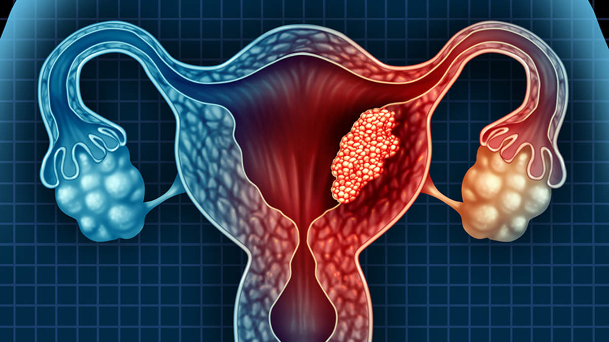 woman holding her lower abdomen