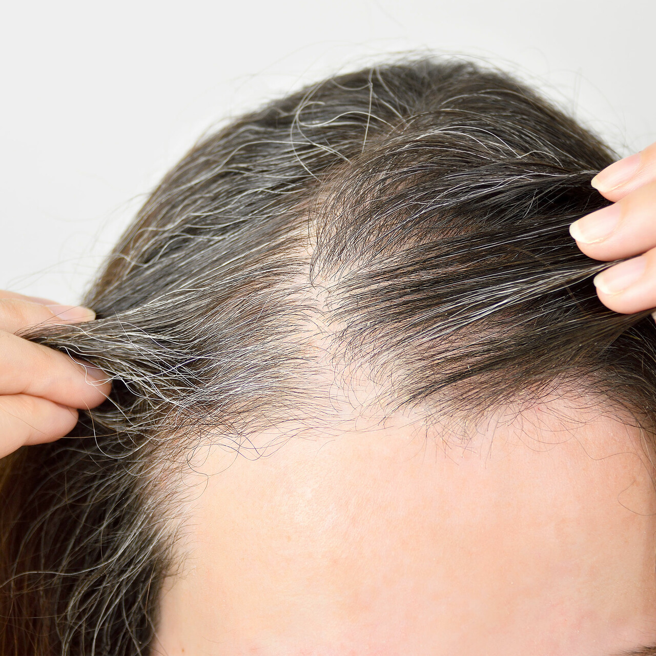 一个脱发妇女的特写