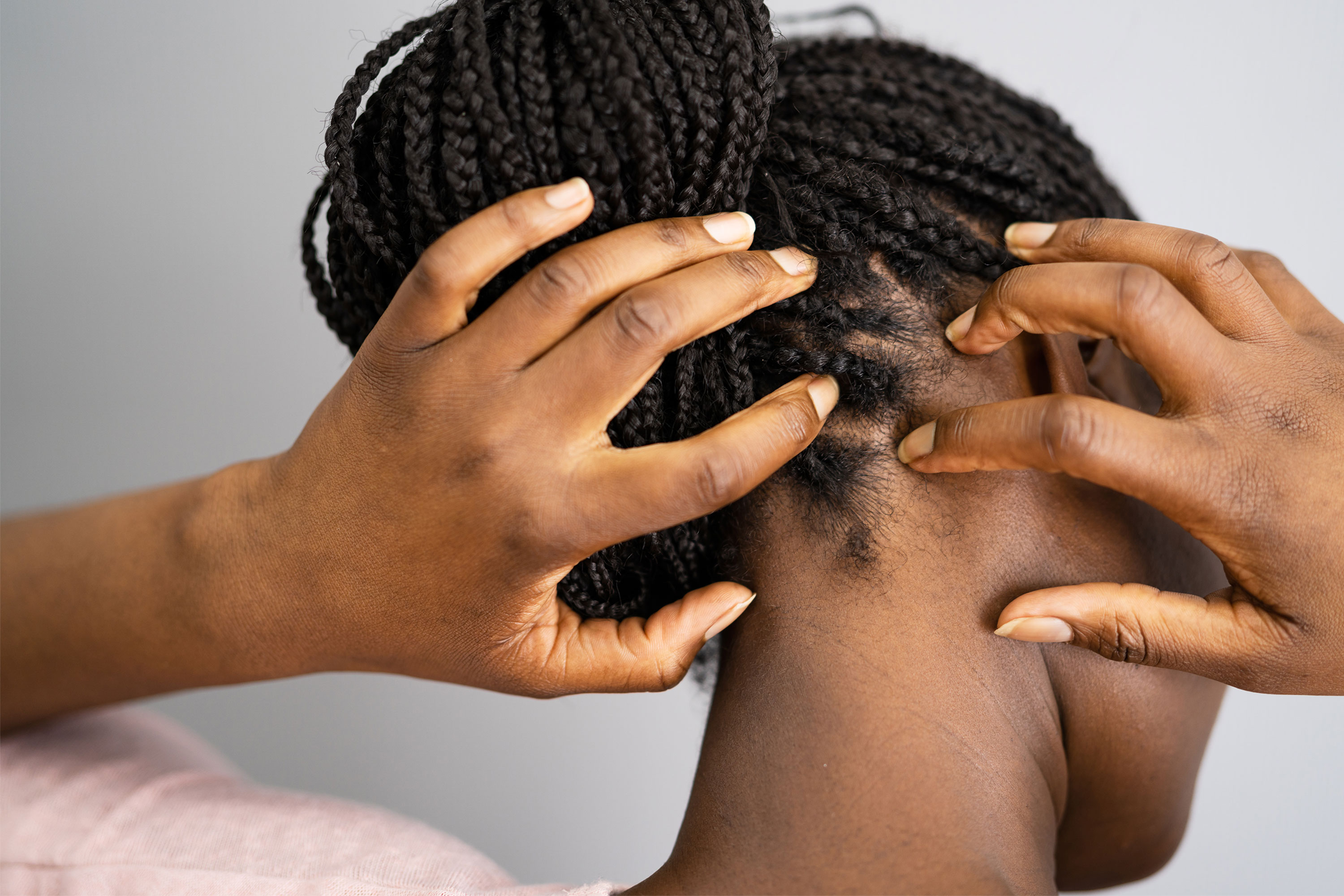 Pain on the scalp | Sore scalp | Try Neofollics