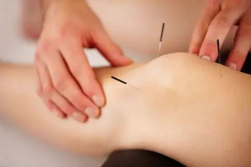 Close-up of a person getting needles in knee