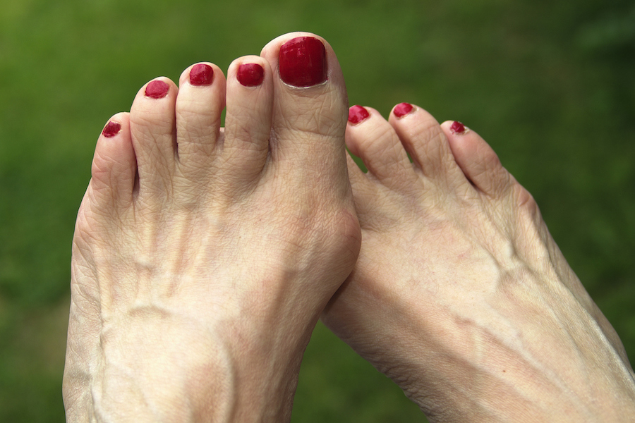 6 Ways Menopause Causes Foot Pain—Plus the Best Solutions