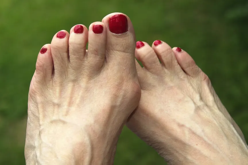 Mature feet and toes