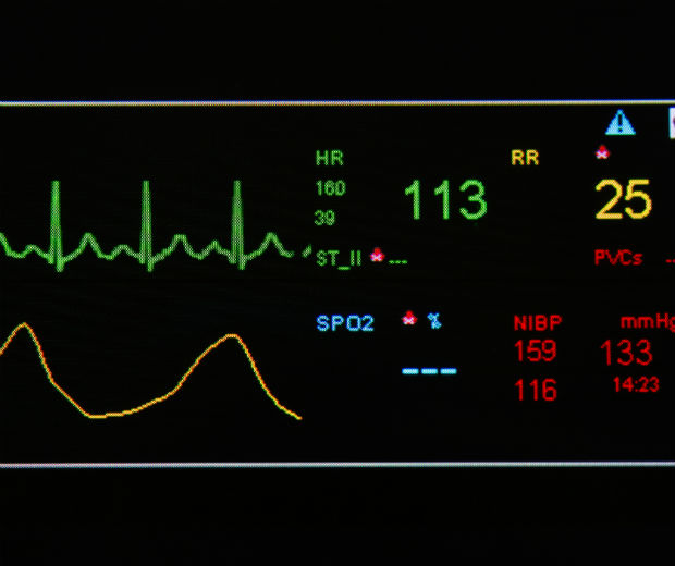 9 Tests for Atrial Fibrillation