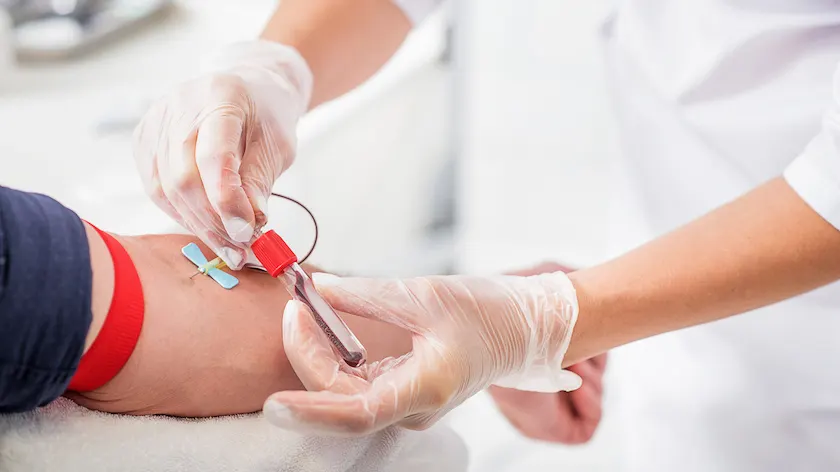 一般从业者绘制血液用于常规测试。