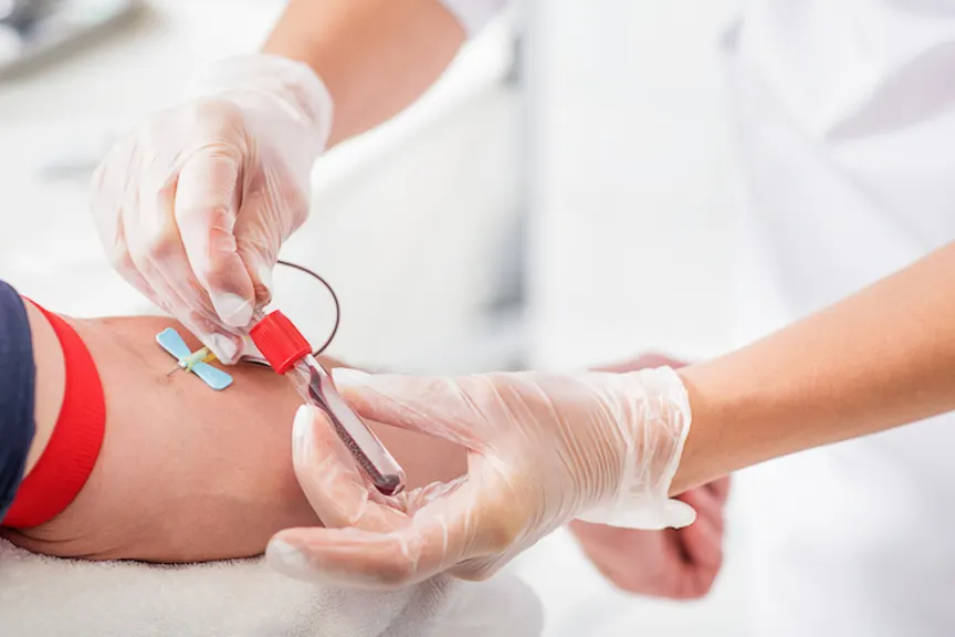 一般从业者绘制血液用于常规测试。