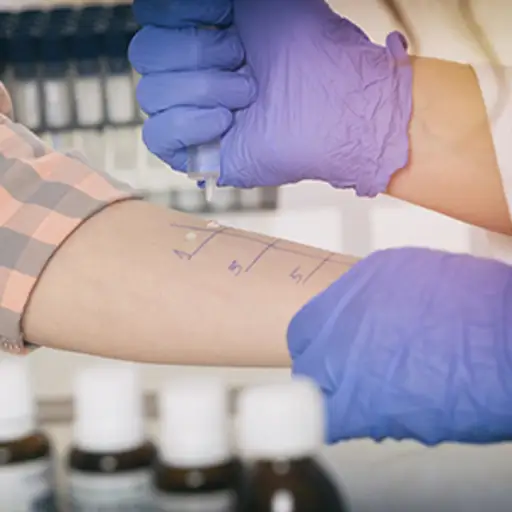 Allergy test.