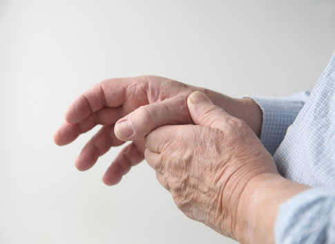 一个人搓着手类风湿性关节炎的关节疼痛。