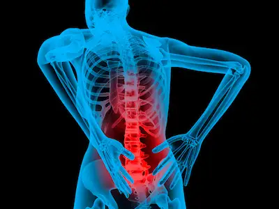 人类的X射线型图像突出显示背部疼痛。