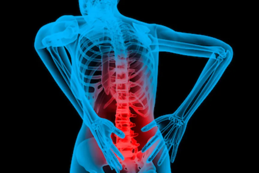 x射线类型的图像突出显示了人类的背部疼痛。