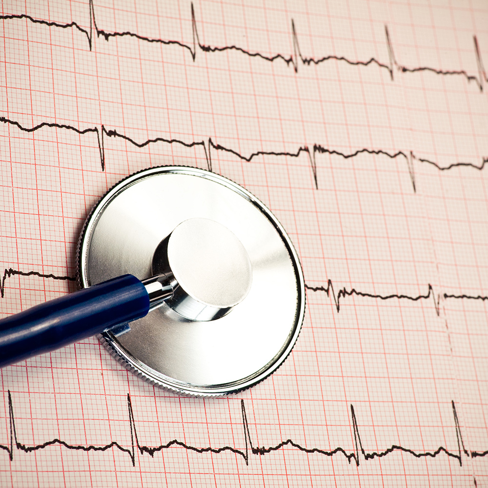 What Is Rate Control Therapy For Afib