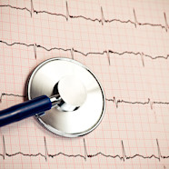 Rate Control Vs Rhythm Control In Treating Atrial Fibrillation Heart 