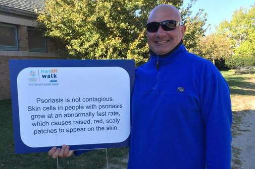 Todd Bello在全国牛皮癣基金会散步时举着一块牌子。