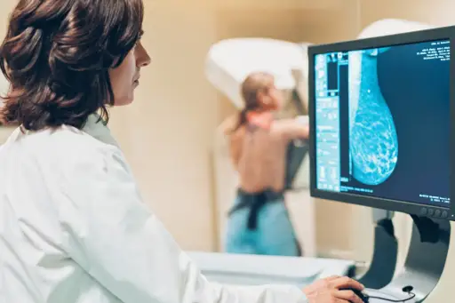 妇科医生正在看乳房扫描